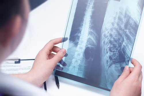 Importance Of Taking Care of Your Spine