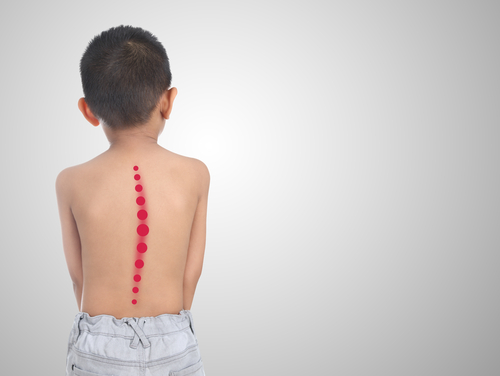 Spine Health for Children Building Strong Backs from a Young Age